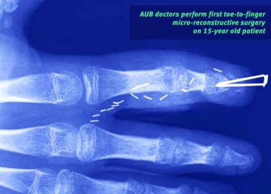 AUBMC Doctors Make History